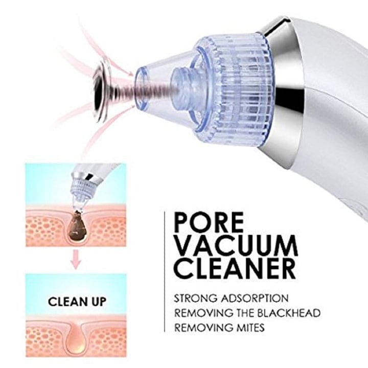 4 in 1 Blackhead Removal Machine - Qifaya