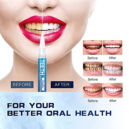 Dazzling Instant White Teeth Whitening Pen - Qifaya