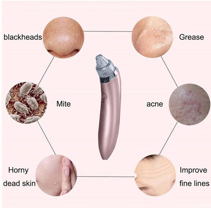 4 in 1 Blackhead Removal Machine - Qifaya