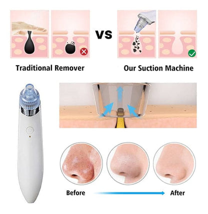 4 in 1 Blackhead Removal Machine - Qifaya