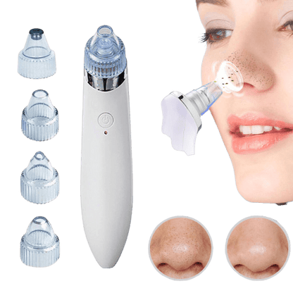 4 in 1 Blackhead Removal Machine - Qifaya
