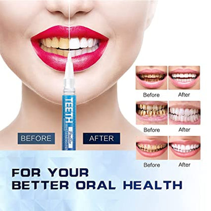 Dazzling Instant White Teeth Whitening Pen - Qifaya