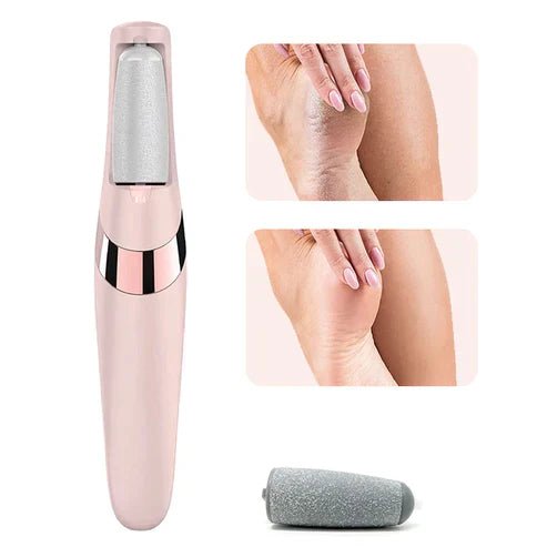 Electric Pedicure Foot File Callus Remover - Qifaya