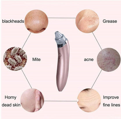 4 in 1 Blackhead Removal Machine - Qifaya